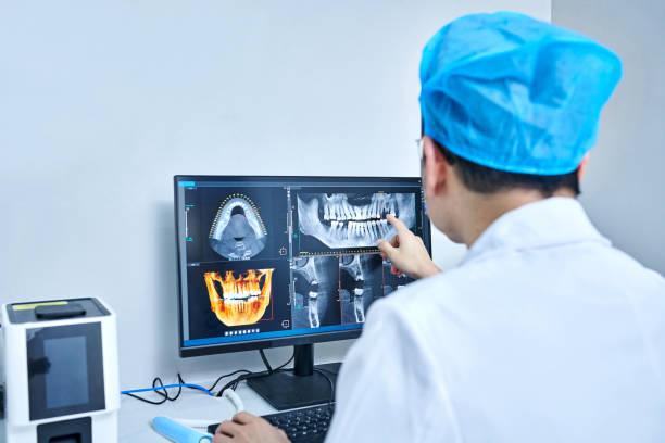 Best Emergency Wisdom Teeth Removal in Apple Valley, UT